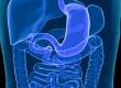 Digestive Disorders